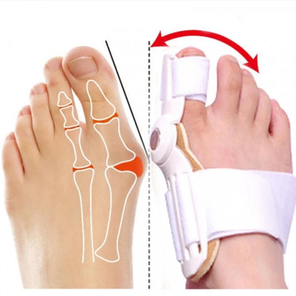 Toe Separator